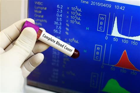 blood counting test|Complete blood count: Definition, purpose, results, and more.